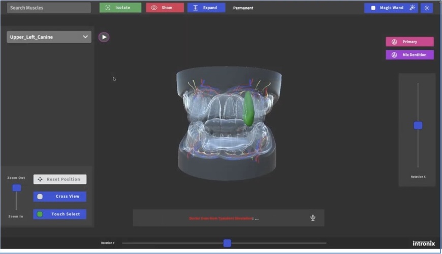 MYOGUIDE Mentor interactive 3D dental typodont used for operative dentistry anatomy visualization and AI-supported preclinical learning.